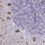 CHD5 Polyclonal Antibody