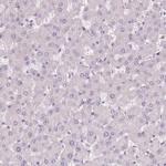 HHLA2 Antibody in Immunohistochemistry (Paraffin) (IHC (P))
