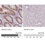 HHLA2 Antibody in Immunohistochemistry (IHC)