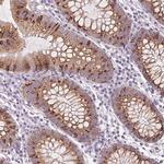 HHLA2 Antibody in Immunohistochemistry (IHC)
