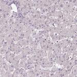 HHLA2 Antibody in Immunohistochemistry (IHC)