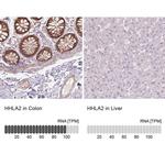 HHLA2 Antibody