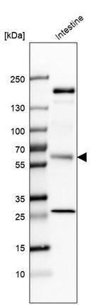 HHLA2 Antibody in Western Blot (WB)