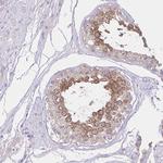 ZNF101 Polyclonal Antibody