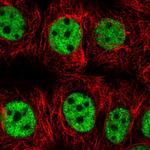 SNRPC Polyclonal Antibody