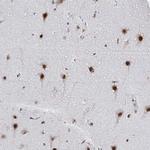SNRPC Antibody in Immunohistochemistry (Paraffin) (IHC (P))