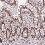 SNRPC Antibody in Immunohistochemistry (Paraffin) (IHC (P))