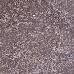 SNRPC Antibody in Immunohistochemistry (Paraffin) (IHC (P))