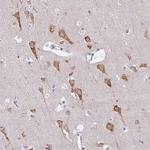 ZFYVE26 Polyclonal Antibody