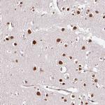 RIPPLY3 Antibody in Immunohistochemistry (Paraffin) (IHC (P))