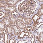 FIGNL1 Antibody in Immunohistochemistry (Paraffin) (IHC (P))