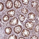 FIGNL1 Antibody in Immunohistochemistry (Paraffin) (IHC (P))