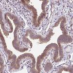 FIGNL1 Antibody in Immunohistochemistry (Paraffin) (IHC (P))
