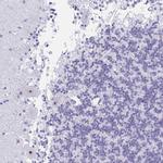 FTSJ3 Antibody in Immunohistochemistry (Paraffin) (IHC (P))