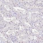 FTSJ3 Antibody in Immunohistochemistry (Paraffin) (IHC (P))