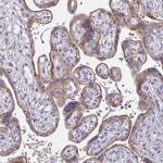 Epsin 3 Antibody in Immunohistochemistry (Paraffin) (IHC (P))