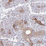 Epsin 3 Antibody in Immunohistochemistry (Paraffin) (IHC (P))