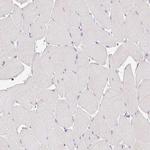 Epsin 3 Antibody in Immunohistochemistry (Paraffin) (IHC (P))