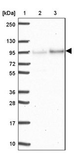 Epsin 3 Antibody in Western Blot (WB)