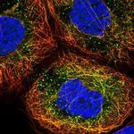 ERI1 Polyclonal Antibody