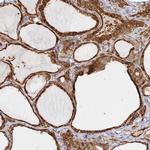 STRAP Antibody in Immunohistochemistry (Paraffin) (IHC (P))