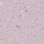 NOS1AP Polyclonal Antibody