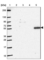 NOS1AP Antibody in Western Blot (WB)