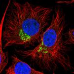 DEPDC5 Polyclonal Antibody