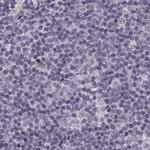SLC28A2 Antibody in Immunohistochemistry (IHC)