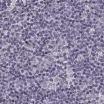 SLC28A2 Antibody in Immunohistochemistry (IHC)