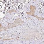 HOXC12 Antibody in Immunohistochemistry (Paraffin) (IHC (P))