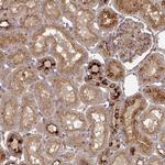 TNMD Antibody in Immunohistochemistry (Paraffin) (IHC (P))