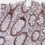 PHF10 Antibody in Immunohistochemistry (Paraffin) (IHC (P))