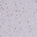 NOXRED1 Polyclonal Antibody