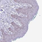 PROSER1 Antibody in Immunohistochemistry (Paraffin) (IHC (P))