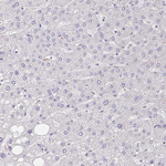 MGAM2 Antibody in Immunohistochemistry (Paraffin) (IHC (P))