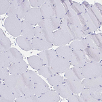 MGAM2 Antibody in Immunohistochemistry (Paraffin) (IHC (P))