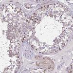 CHST3 Antibody in Immunohistochemistry (IHC)