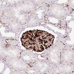 ZFYVE21 Polyclonal Antibody