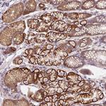 OR4K15 Polyclonal Antibody