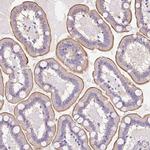 PLS1 Antibody in Immunohistochemistry (Paraffin) (IHC (P))