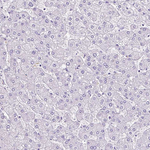 PLS1 Antibody in Immunohistochemistry (Paraffin) (IHC (P))