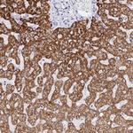 FAM214B Polyclonal Antibody