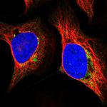 MRPS5 Polyclonal Antibody