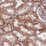MRPS5 Antibody in Immunohistochemistry (Paraffin) (IHC (P))