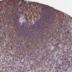 AP5M1 Antibody in Immunohistochemistry (Paraffin) (IHC (P))