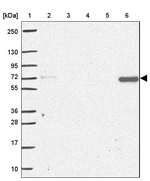 AP5M1 Antibody in Western Blot (WB)