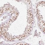ZNF610 Antibody in Immunohistochemistry (IHC)