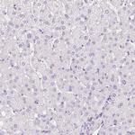 ZNF610 Antibody in Immunohistochemistry (IHC)
