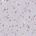 SEMA6B Polyclonal Antibody